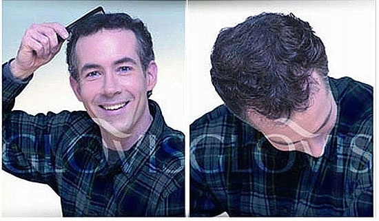 Włókna GLOVIS 50g Eko-Saszetka Mikrowłókna Zagęszczanie Rzadkich