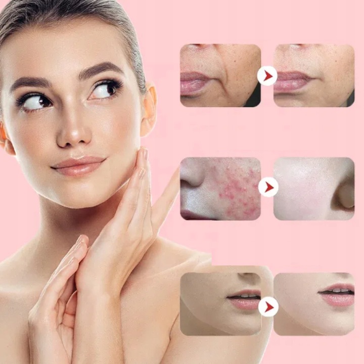 MASAŻ TWARZY MASAŻER LIFTINGUJĄCY UJĘDRNIAJĄCY 7W1 EMS MEZOTERAPIA LIFTING