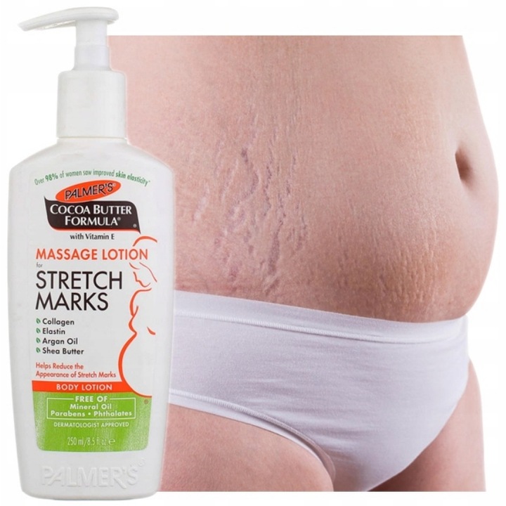 Dobry krem na rozstępy dla nastolatków na plecach brzuchu udach ramionach