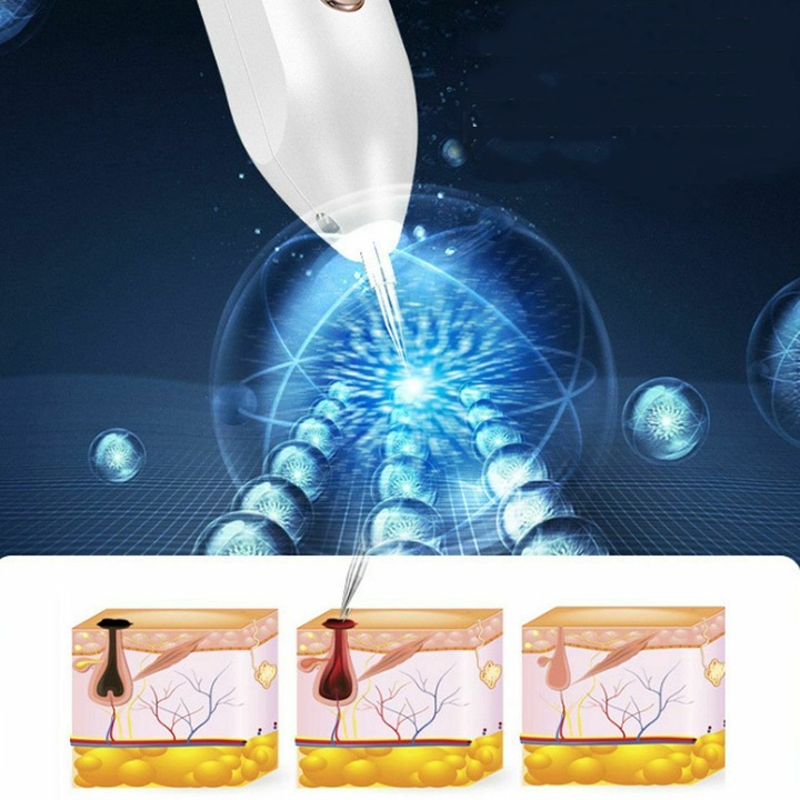 PIÓRO DO LASER USUWANIA ZNAMION PLAZMOWE DO USUWANIA BRODAWEK PIEPRZYK