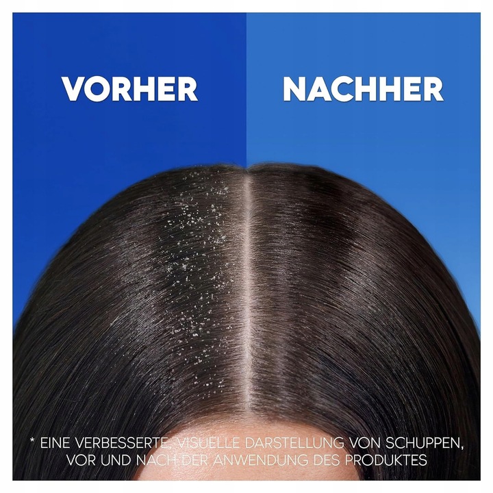 Head & Shoulders Classic Clean Szampon 800ml