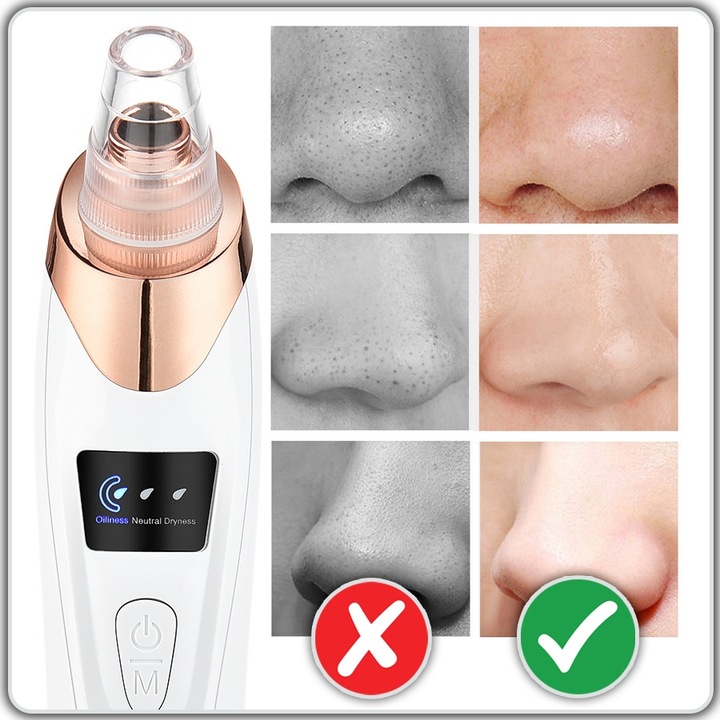 ELEKTRYCZNY PRZYRZĄD ODKURZACZ DO WĄGRÓW PRYSZCZY ZASKÓRNIKÓW 15w1