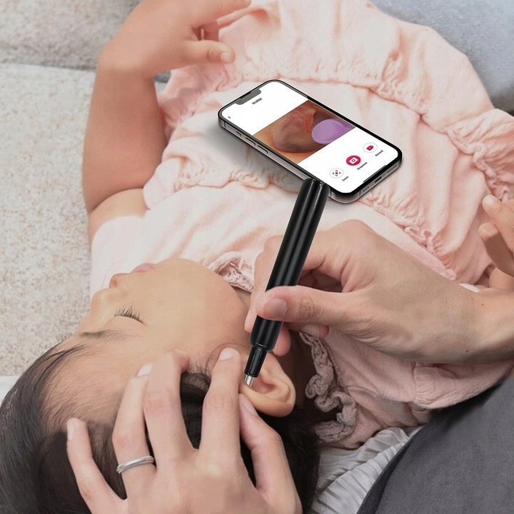 Smart Otoskop Kamera Czyszczenie Uszu Do Usuwania Woskowiny Wosk Wifi