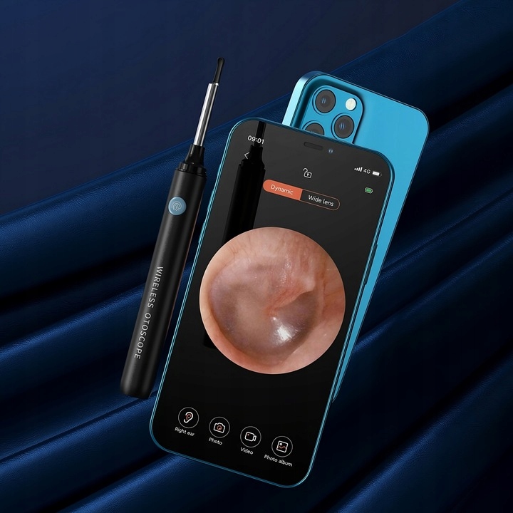 Smart Otoskop Kamera Czyszczenie Uszu Do Usuwania Woskowiny Wosk Wifi