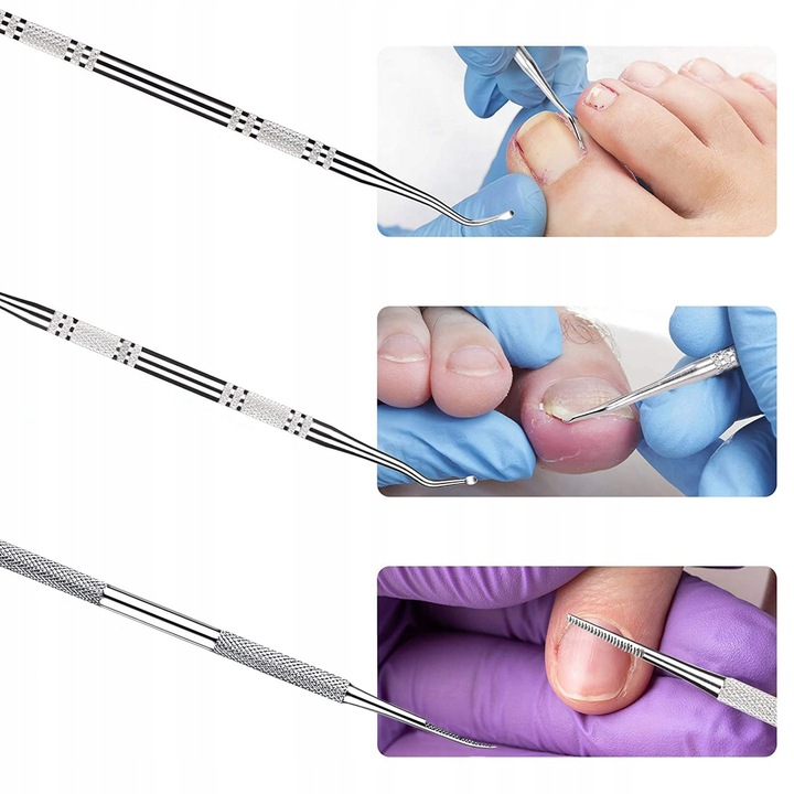 ZESTAW DO WRASTAJĄCYCH PAZNOKCI SONDA PODOLOGICZNA