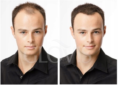 Włókna Mikrowłókna w Sprayu Wodoodporne Zagęszczanie Włosów Naturalny