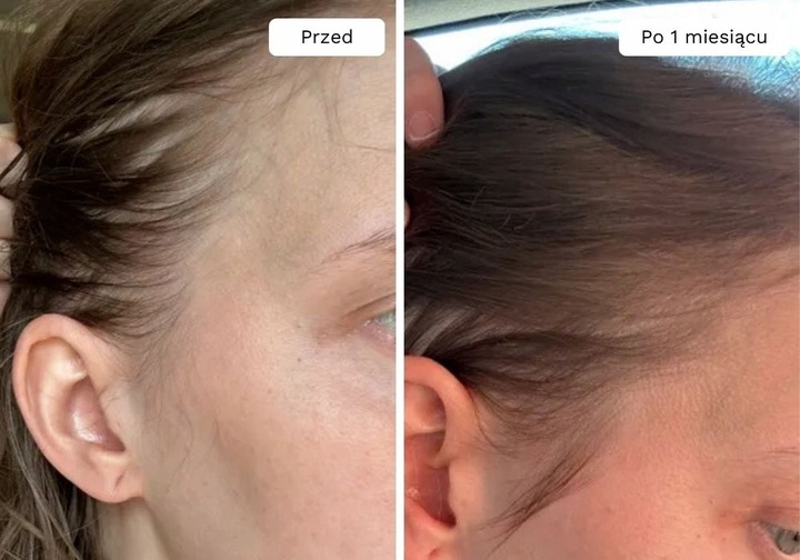 Wcierka Serum na porost i wypadanie włosów wzmacnia cebulki - Lavress 10w1