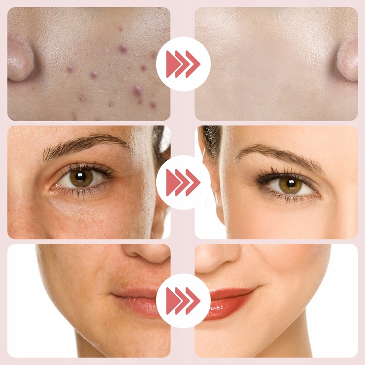 FOONNUN BEZIGŁOWA MASAŻER EMS TWARZY LIFTING 7w1 URZĄDZENIE DO MASAŻU