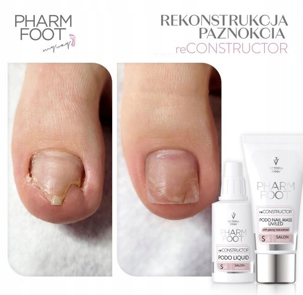 Pharm Foot reCONSTRUCTOR PODO NAIL SET UV/LED