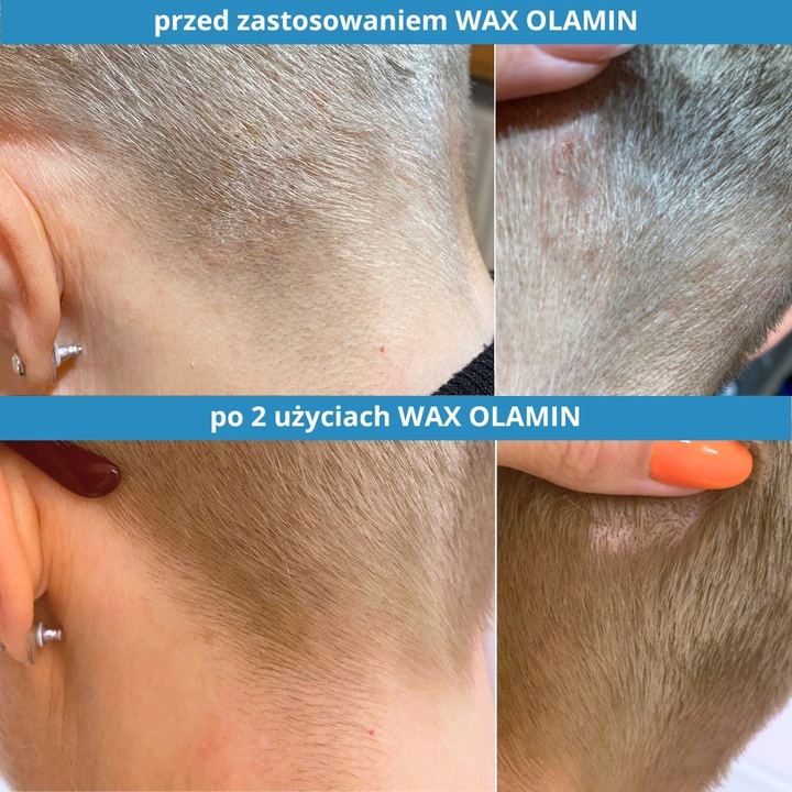 Szampon przeciwłupieżowy i na problematyczną skórę głowy Olamin WAX