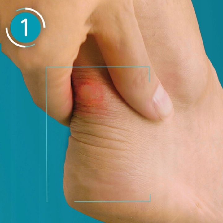 COMPEED Plastry na pęcherze średnie 5 szt.