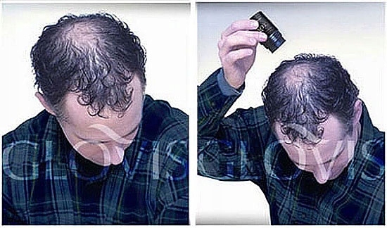 Włókna GLOVIS 28g - Zagęszczanie Włosów Mikrowłókna Łysienie Jakość*