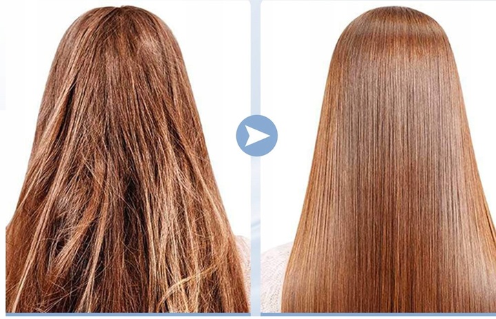 URZĄDZENIE Darsonval Derma Wand PRO LZ006A 4 ELEKTRODY OZON MIKROPRĄDY