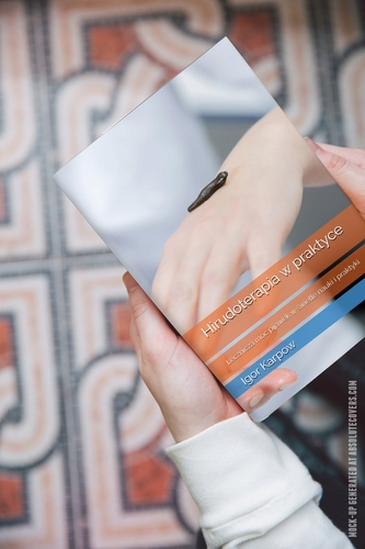 Hirudoterapia w praktyce: Lecznicza moc pijawek w świetle nauki i praktyki