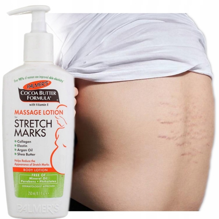 Dobry krem na rozstępy dla nastolatków na plecach brzuchu udach ramionach