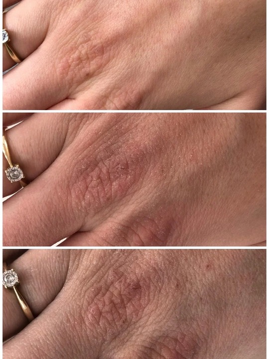 Maść do rąk Hud Salva z witaminą E 100 ml Swederm Hudsalva Vit E