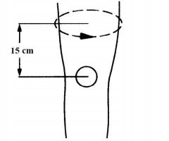 ORTEZA NA KOLANO STABILIZATOR RZEPKI FISZBINY x4 OPASKA STAWU KOLANOWEGO