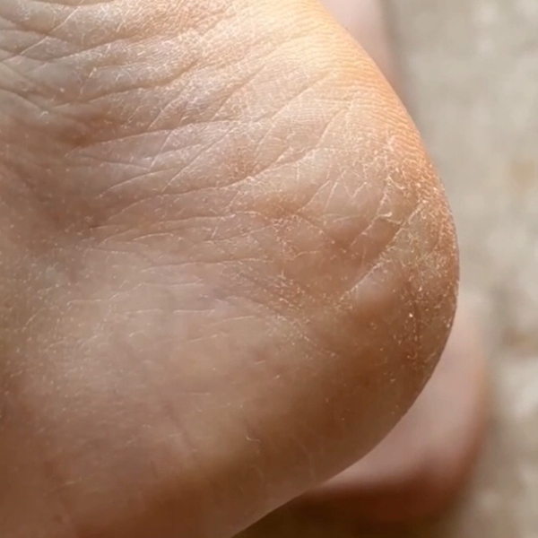 GLOV Pumeks tarka do stóp z nano szkła różowa – usuwa zrogowaciały naskórek