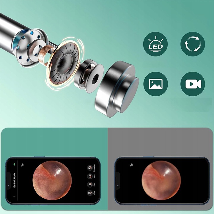 SMART OTOSKOP Z KAMERKĄ WIFI DO CZYSZCZENIA USZU NARZĘDZIA ZESTAW ENDOSKOP
