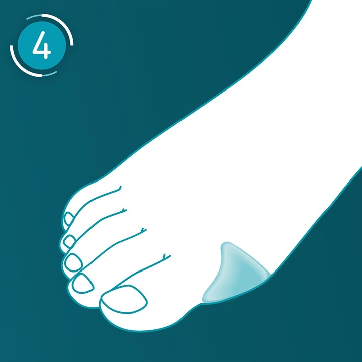COMPEED plastry na halluksy 5 szt x2