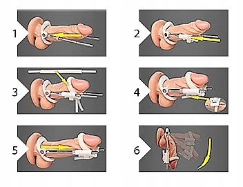 Rozciągacz Penisa PUMPED Penis Extender Czarny
