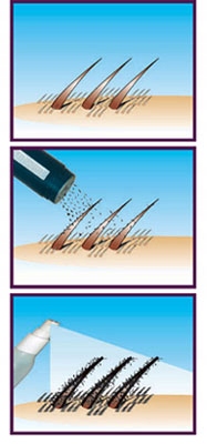 Kosmetyk NANOGEN- zagęszczanie włosów, mikrowłókna