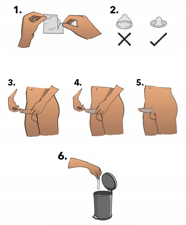 Prezerwatywy SKYN EXTRA LUBRICATED dodatkowo NAWILŻANE nielateksowe 24