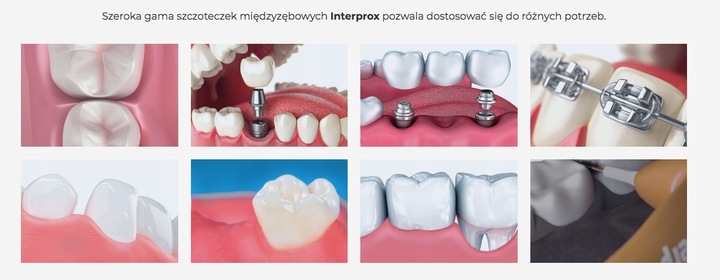 INTERPROX PLUS 2G DENTAID 1,7 CONIC 6 szt.