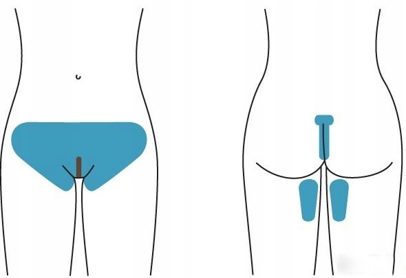 Pasta cukrowa do depilacji miejsc intymnych bikini pupy dla mężczyzn kobiet