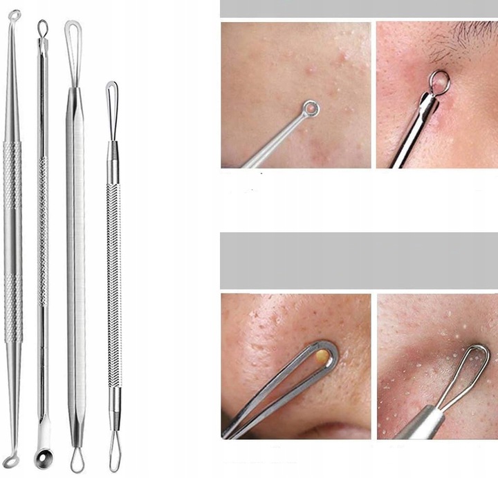 10× łyżeczki UNNY pęseta igła do usuwania zaskórników wągrów pryszczy