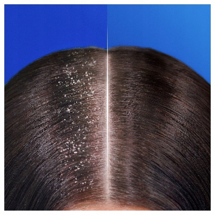 Head & Shoulders Deep Hydration Szampon przeciwłupieżowy do włosów 400ml