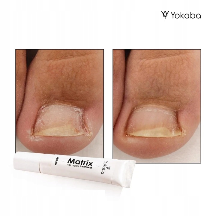 Yokaba Matrix Nail Repair Treatment Preparat do regeneracji paznokci 15ml