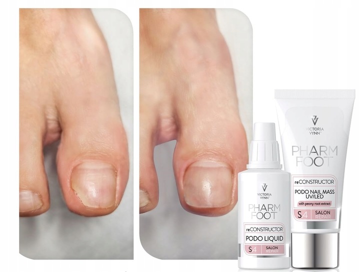 Pharm Foot reCONSTRUCTOR PODO NAIL SET UV/LED