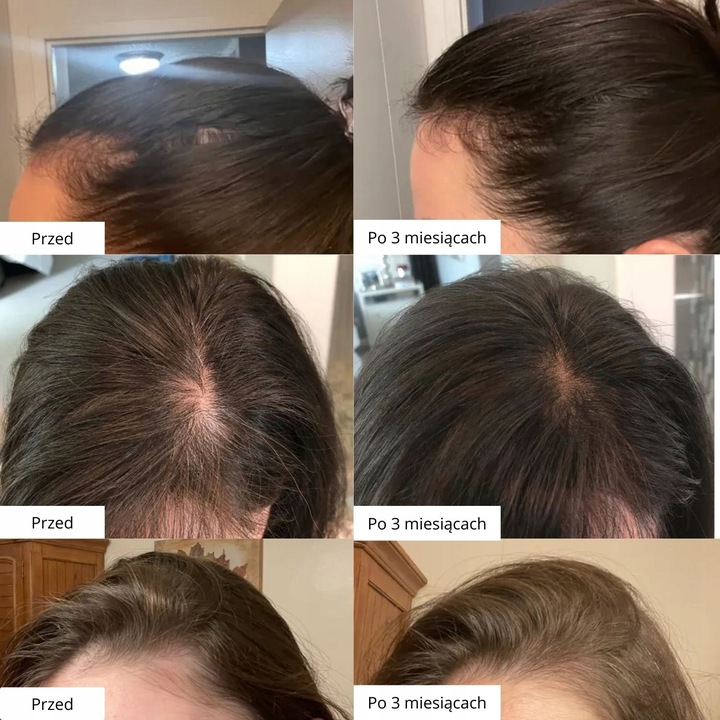 Wcierka Serum na porost i wypadanie włosów wzmacnia cebulki - Lavress 10w1