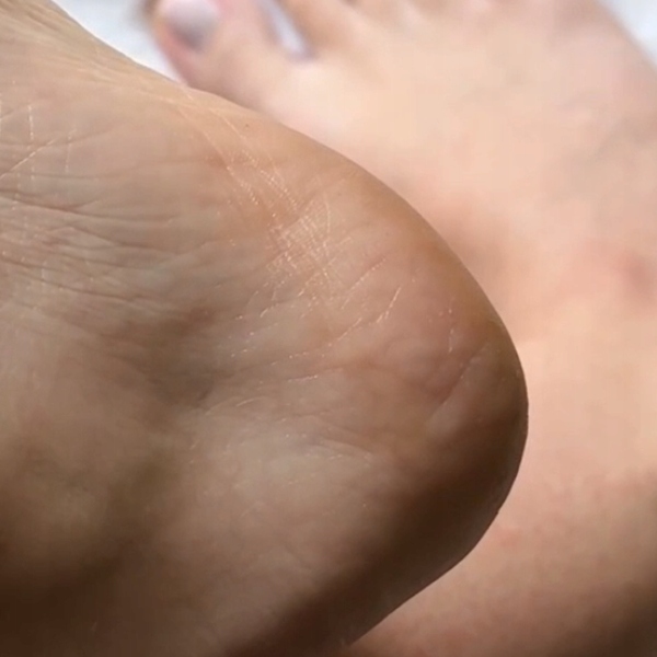 GLOV Pumeks tarka do stóp z nano szkła różowa – usuwa zrogowaciały naskórek