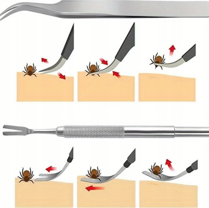 SZCZYPCE PĘSETA DO USUWANIA WYCIĄGANIA KLESZCZY DLA PSA KOTA LUDZI ZESTAW