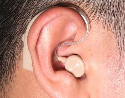 APARAT SŁUCHOWY CERTYFIKOWANY AKUMULATOR WZMACNIACZ SŁUCHU LANDMED