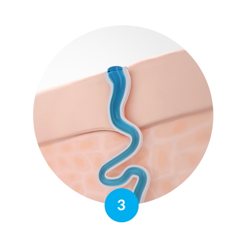 PERSPIREX MEN MAXIMUM ROLL-ON 20ML