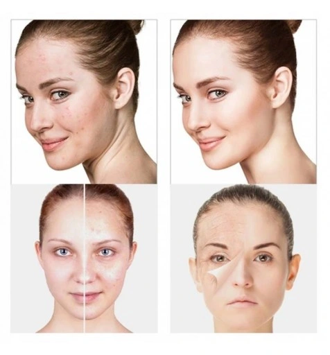 DARSONVAL DERMA WAND DARSONWAL MOCNY 4 PELOTY