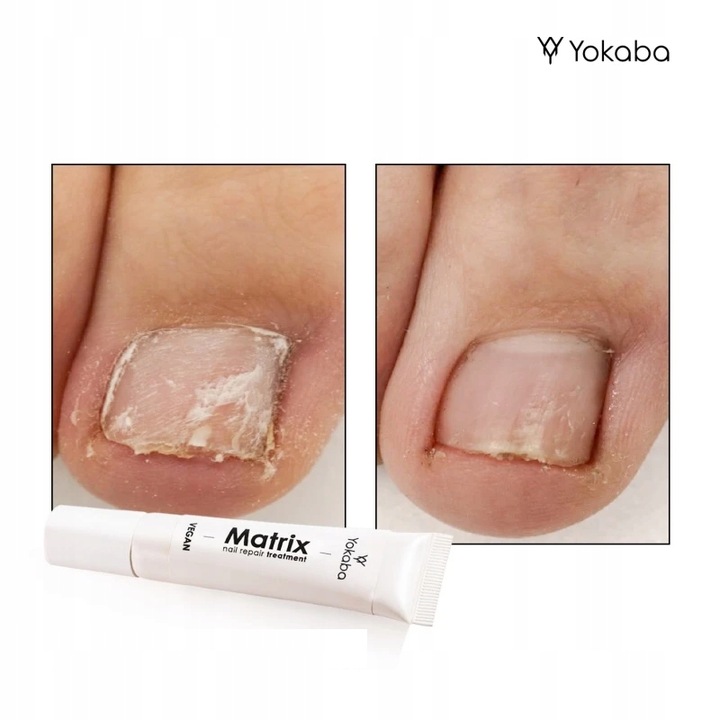 Yokaba Matrix Nail Repair Treatment Preparat do regeneracji paznokci 15ml