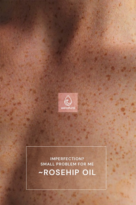Olej z Dzikiej Róży 100ml Wenatural - na trądzik przebarwienia