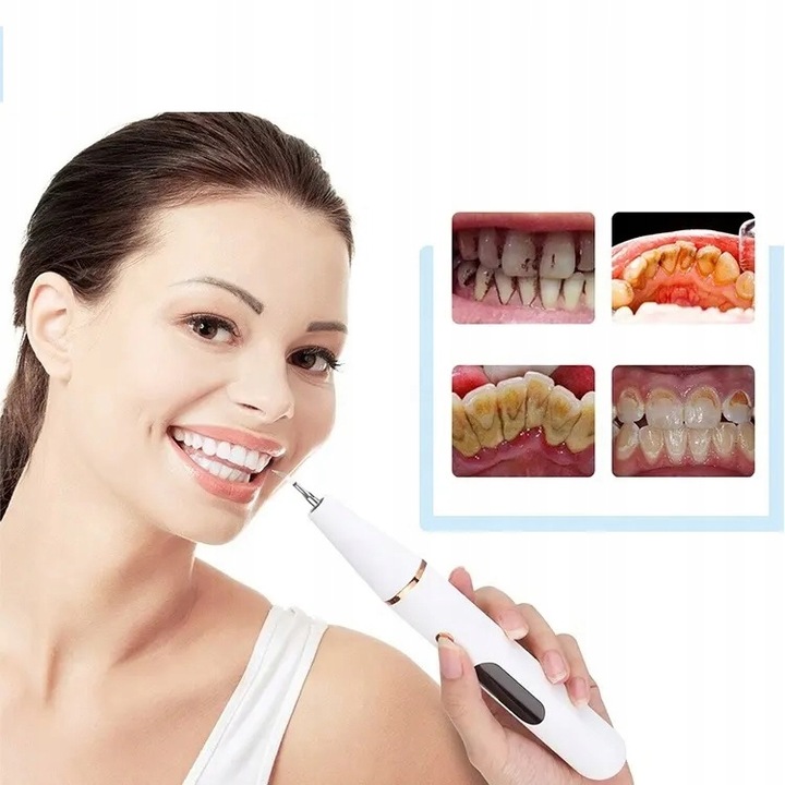 SKALER ULTRADŹWIĘKOWY DO ZĘBÓW DENTYSTYCZNY SMART USUWANIE KAMIENIA