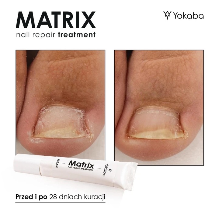 Yokaba MATRIX Preparat do regeneracji macierzy paznokcia 15 ml