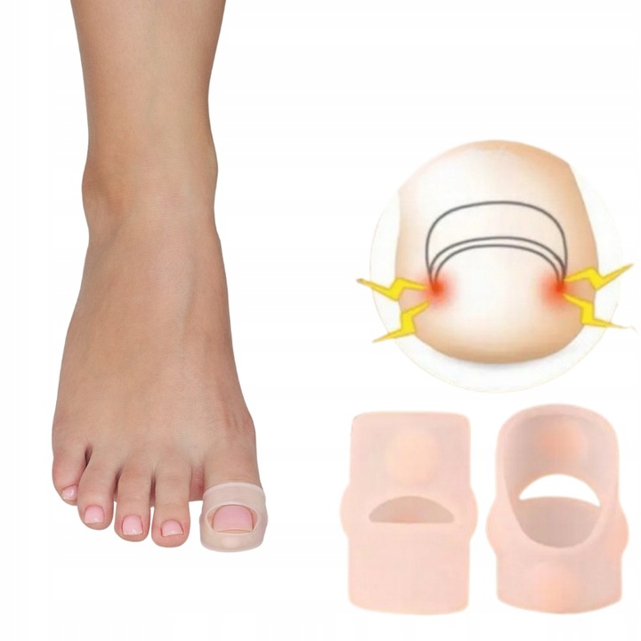 Nakładki silikonowe na wrastający paznokieć N75