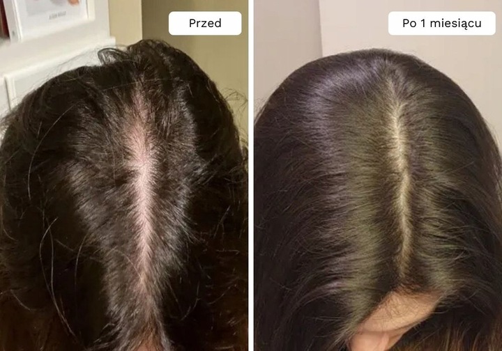 Wcierka Serum na porost i wypadanie włosów wzmacnia cebulki - Lavress 10w1