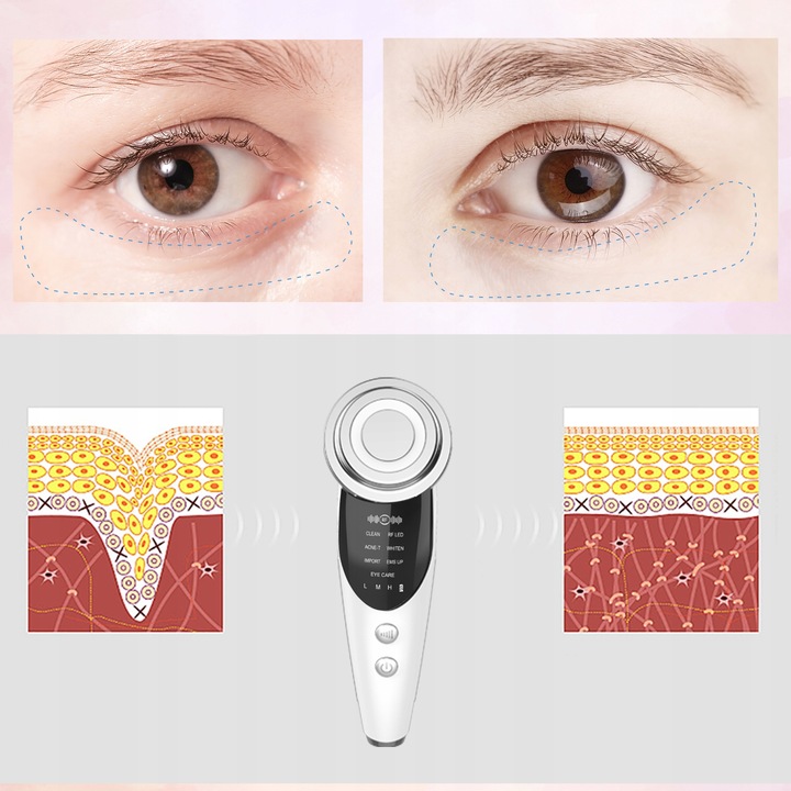 FOONNUN BEZIGŁOWA MASAŻER EMS TWARZY LIFTING 7w1 URZĄDZENIE DO MASAŻU
