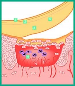 GRANUFLEX EXTRA THIN 7,5x7,5cm 12 SZTUK cienki jak skóra elastyczny