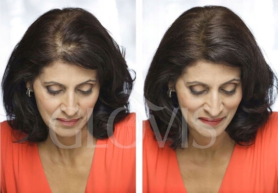 Włókna GLOVIS 50g Eko-Saszetka Mikrowłókna Zagęszczanie Rzadkich