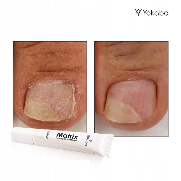 Yokaba Matrix Nail Repair Treatment Preparat do regeneracji paznokci 15ml