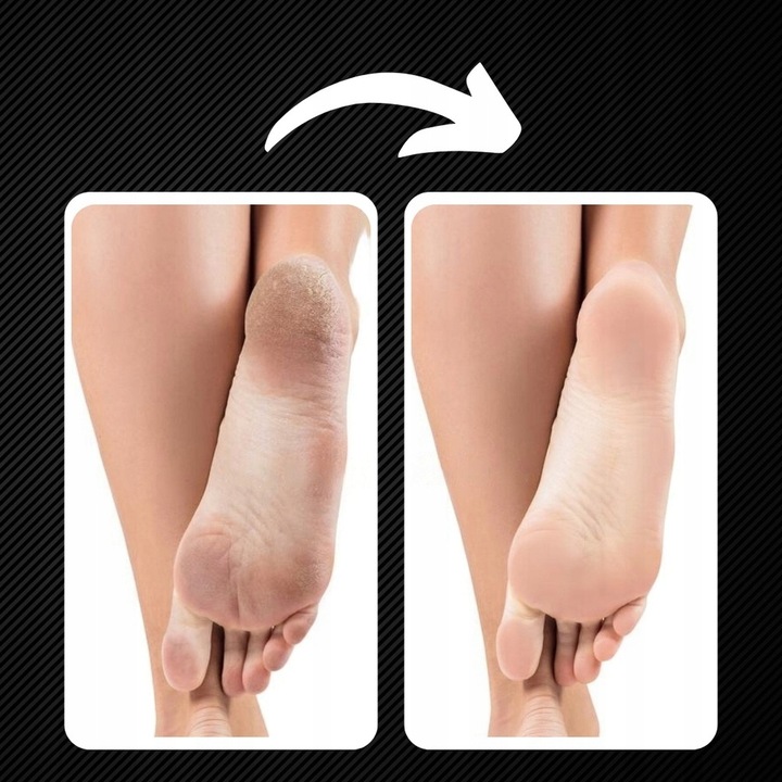 PILNIK DO STÓP MEGA ZESTAW DO PIĘT PILNICZEK ELEKTRYCZNY LED + NASADKI 15w1